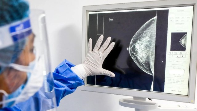 Cáncer de mama: la PUCP y el INEN, juntos en la detección