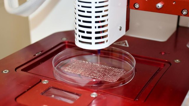 Un parche bioimpreso para cicatrizar heridas crónicas